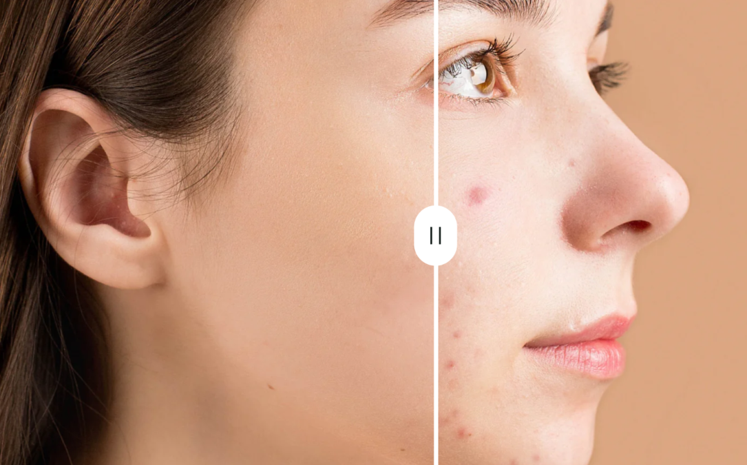 Radiant Results Guaranteed